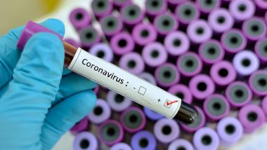 Coronavirus in laboratorio