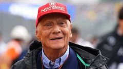 Niki Lauda, migliorano le condizioni a tre giorni dall'operazione